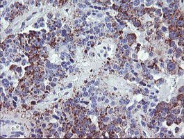 IHC of paraffin-embedded Carcinoma of Human pancreas tissue using anti-NRIP3 mouse monoclonal antibody. (Heat-induced epitope retrieval by 10mM citric buffer, pH6.0, 100C for 10min).