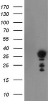 HEK293T cells were transfected with the pCMV6-ENTRY control (Left lane) or pCMV6-ENTRY NRIP3 (Right lane) cDNA for 48 hrs and lysed. Equivalent amounts of cell lysates (5 ug per lane) were separated by SDS-PAGE and immunoblotted with anti-NRIP3.
