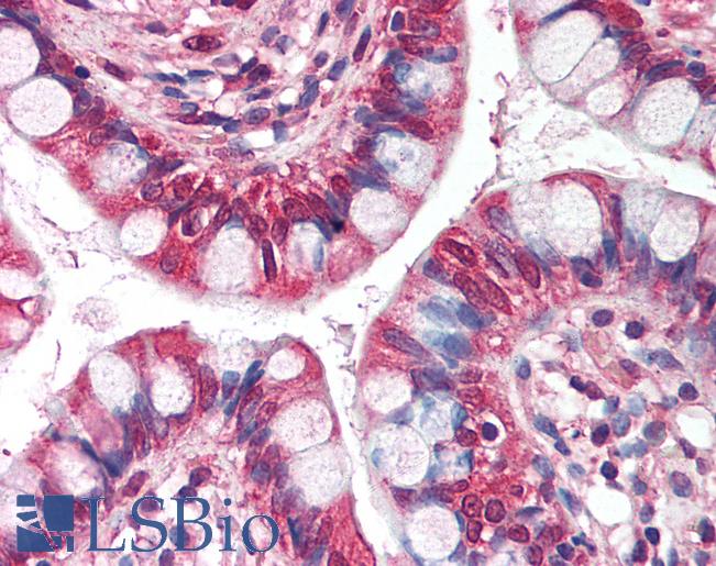 Anti-NRM / Nurim antibody IHC of human small intestine. Immunohistochemistry of formalin-fixed, paraffin-embedded tissue after heat-induced antigen retrieval. Antibody LS-B1979 concentration 5 ug/ml.