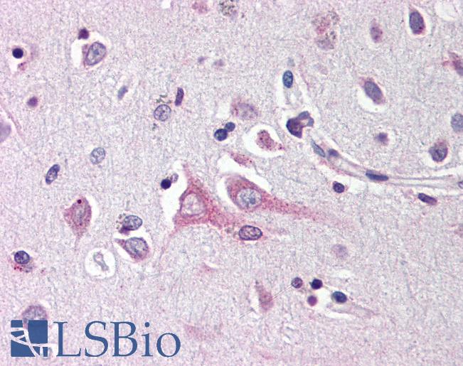 Anti-Neuritin antibody IHC of human brain, cortex. Immunohistochemistry of formalin-fixed, paraffin-embedded tissue after heat-induced antigen retrieval. Antibody LS-B535 concentration 10 ug/ml.
