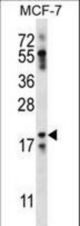 NRN1L Antibody western blot of MCF-7 cell line lysates (35 ug/lane). The NRN1L antibody detected the NRN1L protein (arrow).