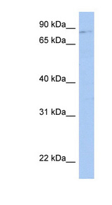 LRRC33 antibody LS-C111745 Western blot of Fetal Kidney lysate.