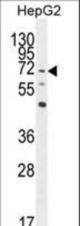 LRRC33 Antibody western blot of HepG2 cell line lysates (35 ug/lane). The LRRC33 antibody detected the LRRC33 protein (arrow).
