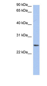 NRSN2 antibody LS-C111244 Western blot of THP-1 cell lysate.