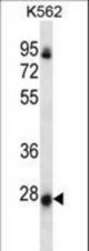 NRSN2 Antibody western blot of K562 cell line lysates (35 ug/lane). The NRSN2 antibody detected the NRSN2 protein (arrow).