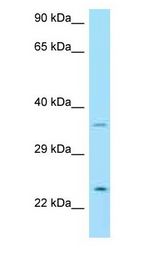 NRTN / Neurturin antibody Western Blot of THP-1.