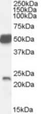 Antibody (0.1 ug/ml) staining of Mouse Brain lysate (35 ug protein in RIPA buffer). Primary incubation was 1 hour. Detected by chemiluminescence.