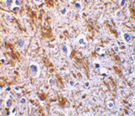 Immunohistochemistry of neurturin in human brain tissue with neurturin antibody at 5 ug/ml.