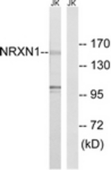 Western blot of extracts from Jurkat cells, using NRXN1 Antibody. The lane on the right was incubated with synthetic peptide.