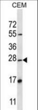 D4S234E Antibody western blot of CEM cell line lysates (35 ug/lane). The D4S234E antibody detected the D4S234E protein (arrow).