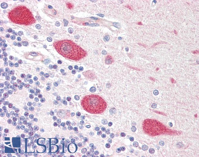 Human Brain, Cerebellum: Formalin-Fixed, Paraffin-Embedded (FFPE)
