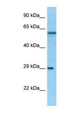 NSL1 antibody LS-C146220 Western blot of HeLa Cell lysate. Antibody concentration 1 ug/ml.