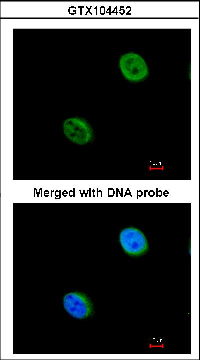 Immunofluorescence of paraformaldehyde-fixed HeLa using DC8 antibody at 1:200 dilution.