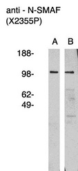 Western blot of anti nSMAF antibody (LS-C140610) on human brain lysate (A) and RMS-13 rhabdosarcoma cell lysate (B). Lysate used at 15 ug/lane. Antibody used at 1:400 dilution. Secondary antibody, mouse anti-rabbit HRP, used at 1:50k dilution. Visualized using Pierce West Femto substrate system. Exposure for 5 minutes