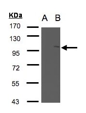 Western blot of NSMAF expression in transfected 293T cell line by NSMAF polyclonal antibody. A: Non-transfected lysate., B: NSMAF transfected lysate. 7.5% SDS PAGE. NSMAF antibody diluted at 1:500