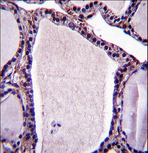 NSMAF Antibody immunohistochemistry of formalin-fixed and paraffin-embedded human thyroid tissue followed by peroxidase-conjugated secondary antibody and DAB staining.