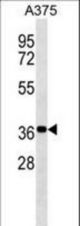 NSMCE1 Antibody western blot of A375 cell line lysates (35 ug/lane). The NSMCE1 Antibody detected the NSMCE1 protein (arrow).