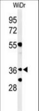 Western blot of NSE4A Antibody in WiDr cell line lysates (35 ug/lane). NSE4A (arrow) was detected using the purified antibody.
