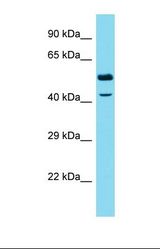 Western blot of Human HepG2 cell lysate. NSMCE4A antibody dilution 1.0 ug/ml.