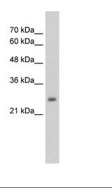HepG2 Cell Lysate