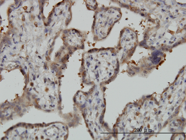 Immunoperoxidase of monoclonal antibody to NT5C2 on formalin-fixed paraffin-embedded human placenta. [antibody concentration 3 ug/ml]