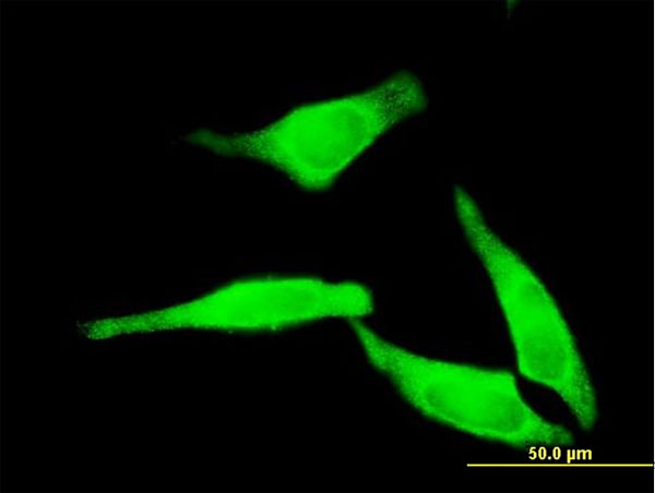 Immunofluorescence of monoclonal antibody to NT5C2 on HeLa cell. [antibody concentration 10 ug/ml].