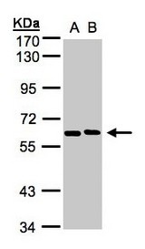 Sample (30 ug whole cell lysate). A: H1299, B: HeLa S3. 7.5% SDS PAGE. NT5C2 antibody diluted at 1:1000