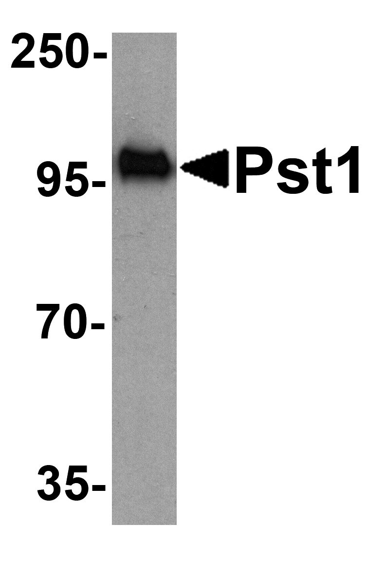 Western blot analysis of TM yeast Pst1 protein (50 ng) with Pst1 antibody at 1 ug/ml.