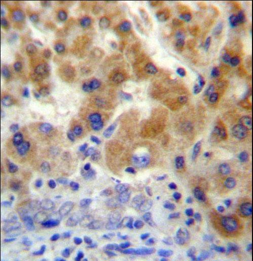 NT5C3L Antibody immunohistochemistry of formalin-fixed and paraffin-embedded human liver tissue followed by peroxidase-conjugated secondary antibody and DAB staining.