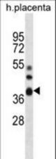 NT5C3L Antibody western blot of human placenta tissue lysates (35 ug/lane). The NT5C3L antibody detected the NT5C3L protein (arrow).