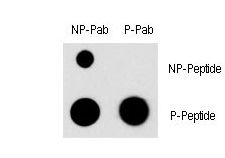 Dot blot of Phospho-MEF2C-S396 Antibody and MEF2C Non Phospho-specific antibody on nitrocellulose membrane. 50ng of Phospho-peptide or Non Phospho-peptide per dot were adsorbed. Antibody working concentrations are 0.5ug per ml.