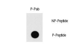 Dot blot of Phospho-MEF2C-T20 antibody on nitrocellulose membrane. 50ng of Phospho-peptide or Non Phospho-peptide per dot were adsorbed. Antibody working concentration was 0.5ug per ml. P-antibody: phospho-antibody; P-Peptide: phospho-peptide; NP-Peptide: non-phospho-peptide.