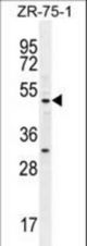 MEF2D Antibody western blot of ZR-75-1 cell line lysates (35 ug/lane). The MEF2D antibody detected the MEF2D protein (arrow).