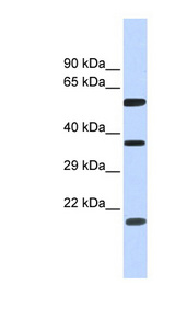 NT5DC1 antibody LS-C111660 Western blot of Fetal Brain lysate.