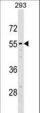 NT5D2 Antibody western blot of 293 cell line lysates (35 ug/lane). The NT5D2 antibody detected the NT5D2 protein (arrow).