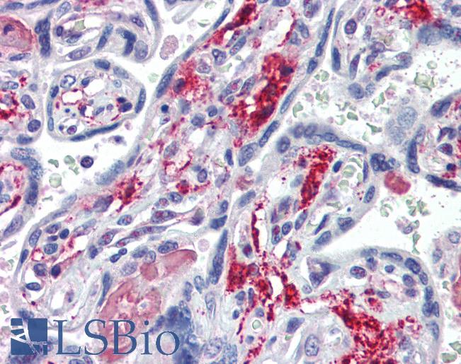 Anti-NT5E / CD73 antibody IHC of human placenta. Immunohistochemistry of formalin-fixed, paraffin-embedded tissue after heat-induced antigen retrieval. Antibody LS-B3428 concentration 10 ug/ml.