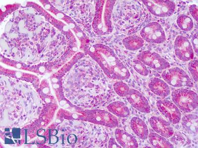 Anti-CD73 antibody IHC of human small intestine. Immunohistochemistry of formalin-fixed, paraffin-embedded tissue after heat-induced antigen retrieval. Antibody LS-B8284 dilution 5-10 ug/ml.