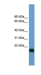 NT5M antibody LS-C116674 Western blot of A549 cell lysate.