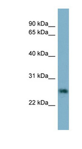 NTF4 / Neurotrophin 4 antibody LS-C107915 Western blot of HT1080 cell lysate.
