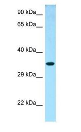 NTHL1 antibody Western Blot of Fetal Lung.