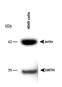 Western blot of A549 cells using LS-C2739. A band is seen at 35 kD representing NTH1.
