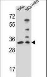 NTHL1 Antibody (Center R103) western blot of HeLa,NCI-H460 cell line lysates (35 ug/lane). The NTHL1 antibody detected the NTHL1 protein (arrow).
