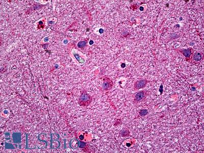 Anti-NTM antibody IHC of human brain, cortex. Immunohistochemistry of formalin-fixed, paraffin-embedded tissue after heat-induced antigen retrieval. Antibody LS-B5442 concentration 5 ug/ml.