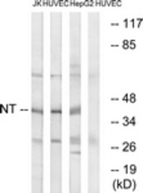 Western blot of extracts from HUVEC/HepG2/Jurkat cells, using NT Antibody. The lane on the right is treated with the synthesized peptide.