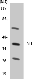 Western blot of the lysates from HepG2 cells using NT antibody.