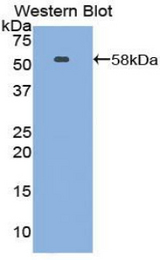 Western blot of recombinant NTN1 / Netrin 1.