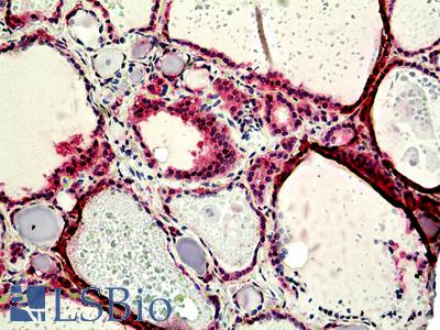 Anti-Netrin 1 antibody IHC of human thyroid. Immunohistochemistry of formalin-fixed, paraffin-embedded tissue after heat-induced antigen retrieval. Antibody LS-B5109 concentration 3.75 ug/ml.