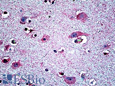 Anti-Netrin 1 antibody IHC of human brain, cortex. Immunohistochemistry of formalin-fixed, paraffin-embedded tissue after heat-induced antigen retrieval. Antibody LS-B5109 concentration 3.75 ug/ml.