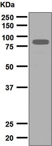 Western blot analysis on 10 ng of mouse Netrin 1 recombinant protein using anti-Netrin-1 antibody. The molecular weight of recombinant protein is 83 kDa.