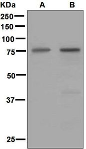 Western blot analysis on (A) fetal brain and (B) human small intestine lysates using anti-Netrin 1 antibody.